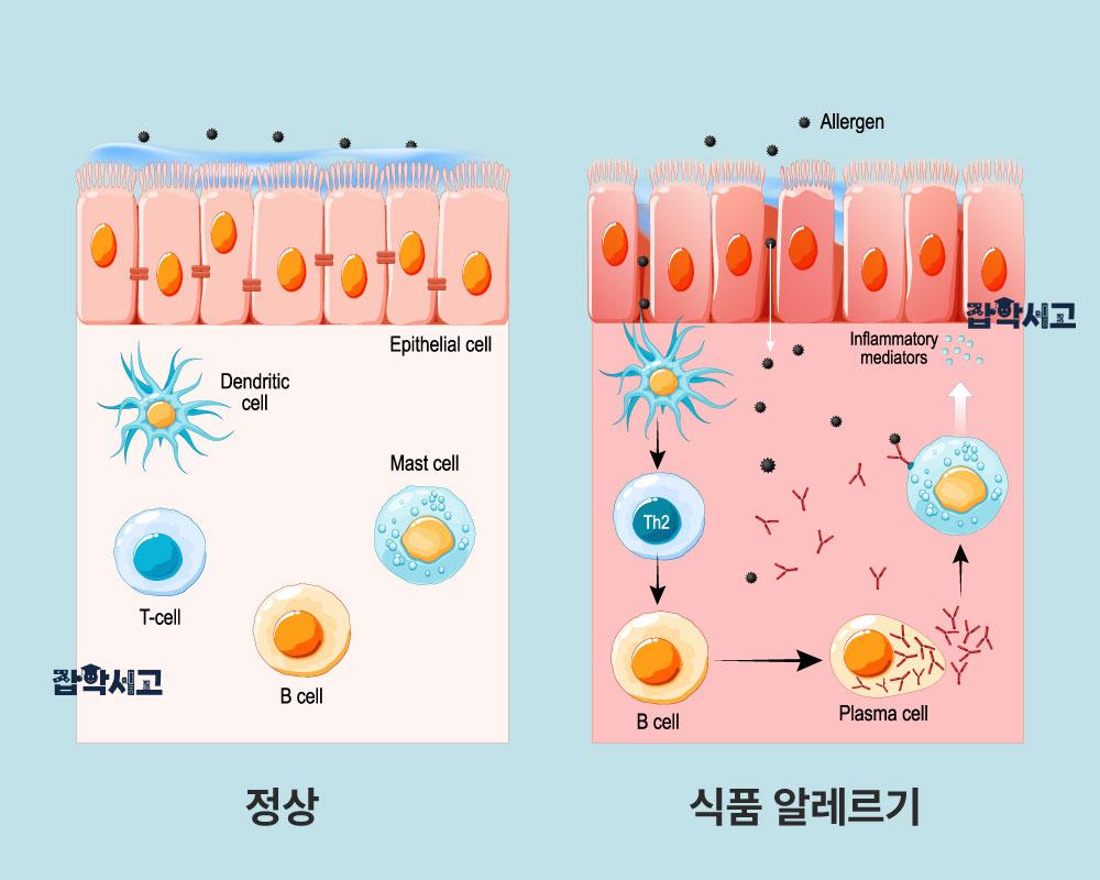 식품 알레르기 발현 원리