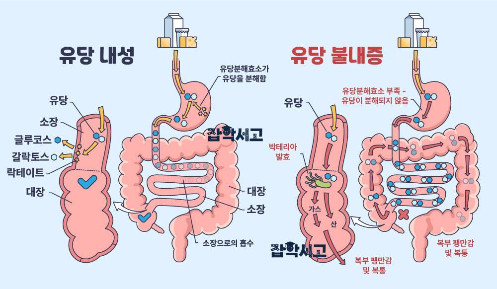 유당불내증이란 무엇인가?